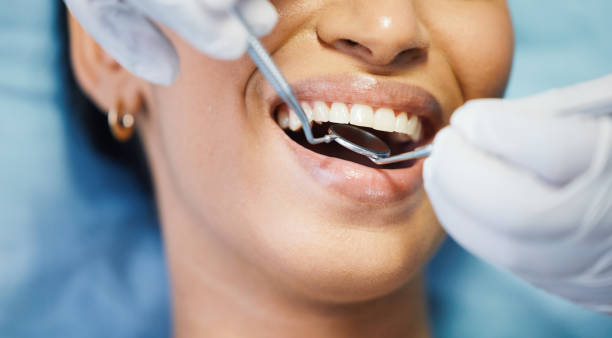 Best Emergency Tooth Extraction in Hollandale, MS