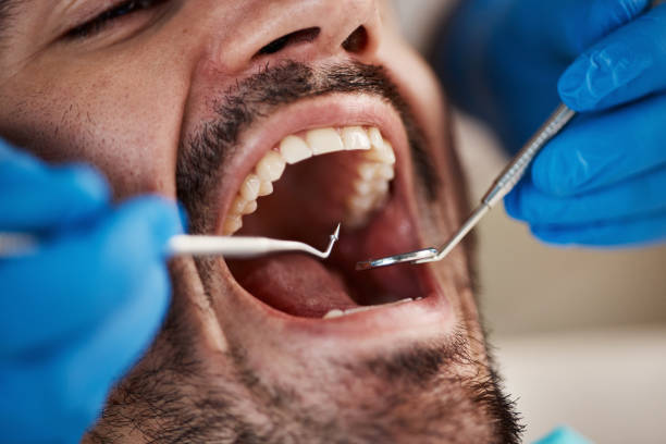 Best Urgent Care for Lost Fillings or Crowns in Hollandale, MS