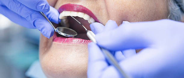 Best Emergency Dental Care for Broken or Chipped Teeth in Hollandale, MS